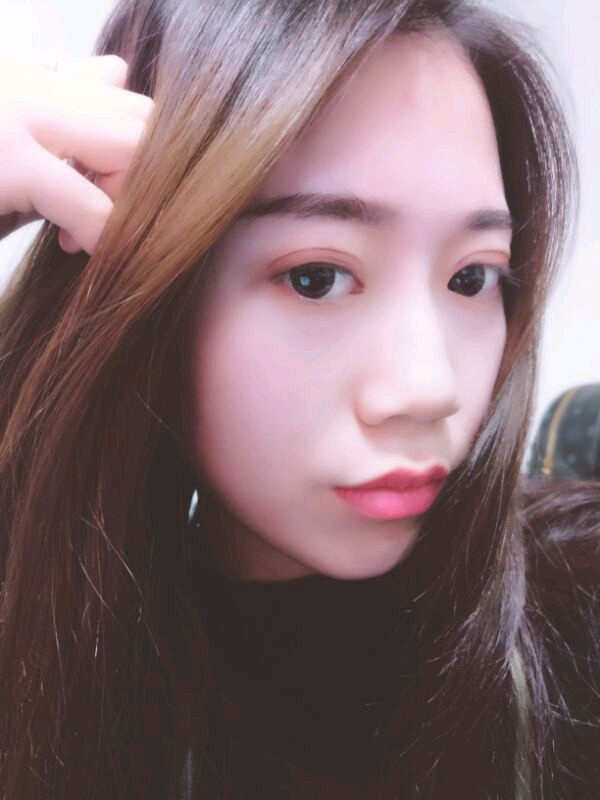 姐妹们,都来看看我的案例吧!!以前内双的眼皮晚上喝水喝得多第二天眼睛都会肿很久,现在拥有双眼皮之后再也不用担心了~~~