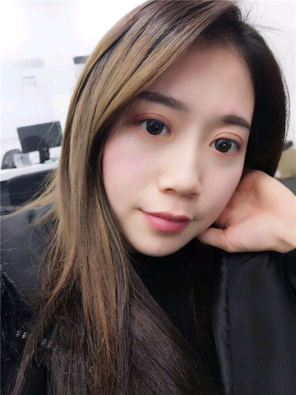 姐妹们,都来看看我的案例吧!!以前内双的眼皮晚上喝水喝得多第二天眼睛都会肿很久,现在拥有双眼皮之后再也不用担心了~~~
