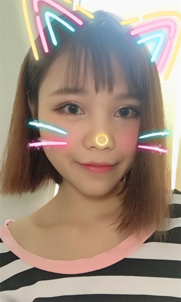 姐妹们,你们喜欢M唇吗?我做了M唇和自体脂肪填充额头,大家都来看看,觉得我做的怎么样呢?
