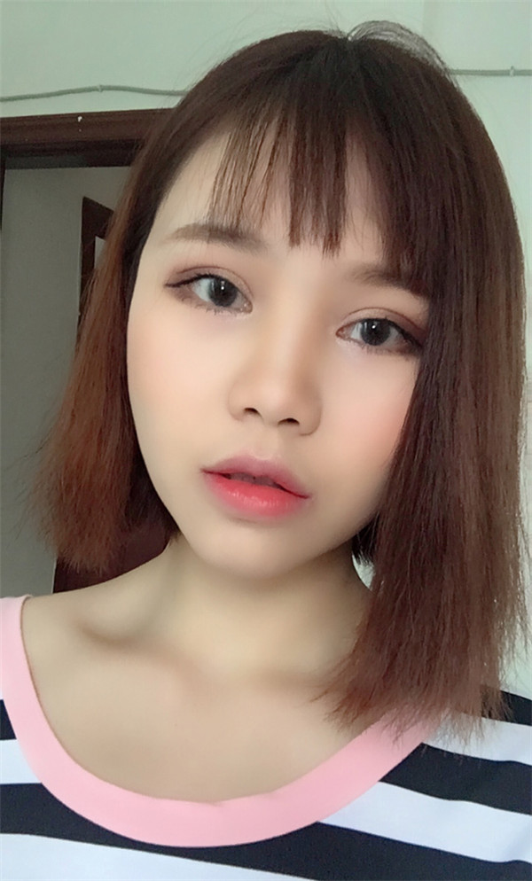 姐妹们,你们喜欢M唇吗?我做了M唇和自体脂肪填充额头,大家都来看看,觉得我做的怎么样呢?