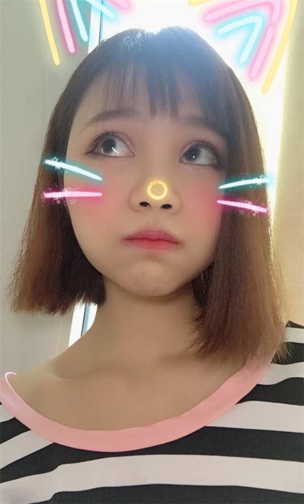 姐妹们,你们喜欢M唇吗?我做了M唇和自体脂肪填充额头,大家都来看看,觉得我做的怎么样呢?