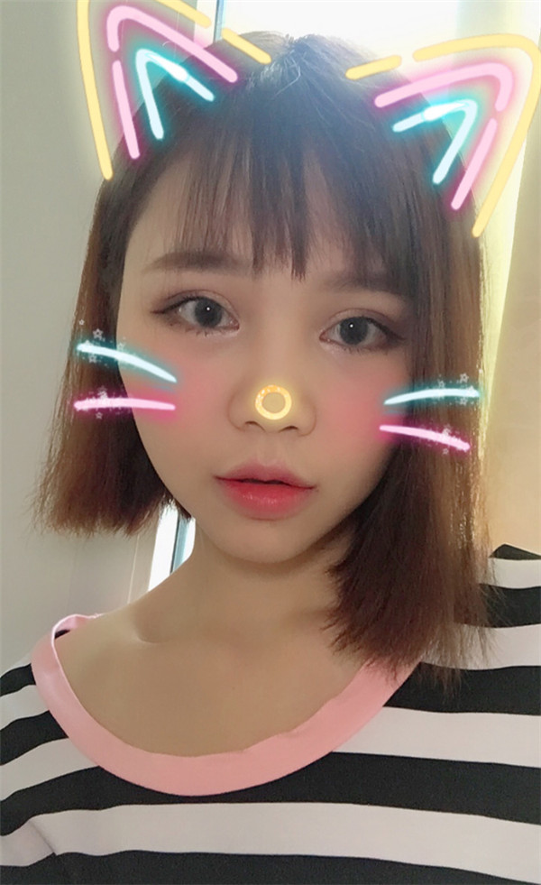 姐妹们,你们喜欢M唇吗?我做了M唇和自体脂肪填充额头,大家都来看看,觉得我做的怎么样呢?