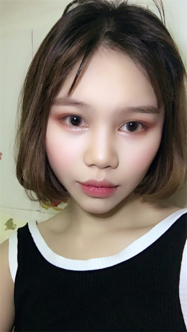 姐妹们,你们喜欢M唇吗?我做了M唇和自体脂肪填充额头,大家都来看看,觉得我做的怎么样呢?