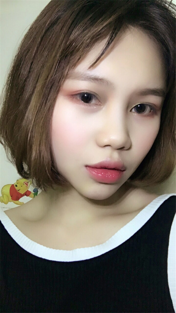 姐妹们,你们喜欢M唇吗?我做了M唇和自体脂肪填充额头,大家都来看看,觉得我做的怎么样呢?