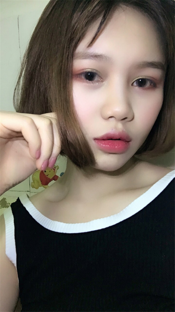 姐妹们,你们喜欢M唇吗?我做了M唇和自体脂肪填充额头,大家都来看看,觉得我做的怎么样呢?