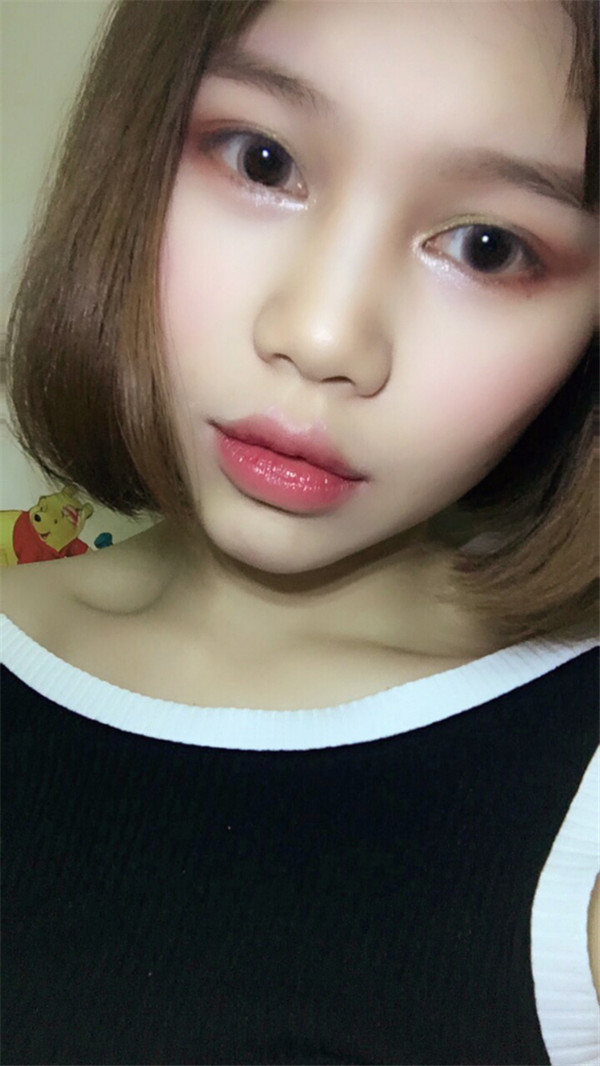 姐妹们,你们喜欢M唇吗?我做了M唇和自体脂肪填充额头,大家都来看看,觉得我做的怎么样呢?