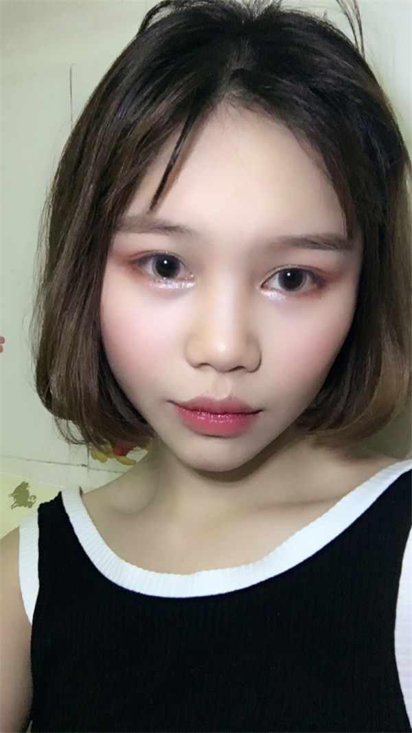 姐妹们,你们喜欢M唇吗?我做了M唇和自体脂肪填充额头,大家都来看看,觉得我做的怎么样呢?