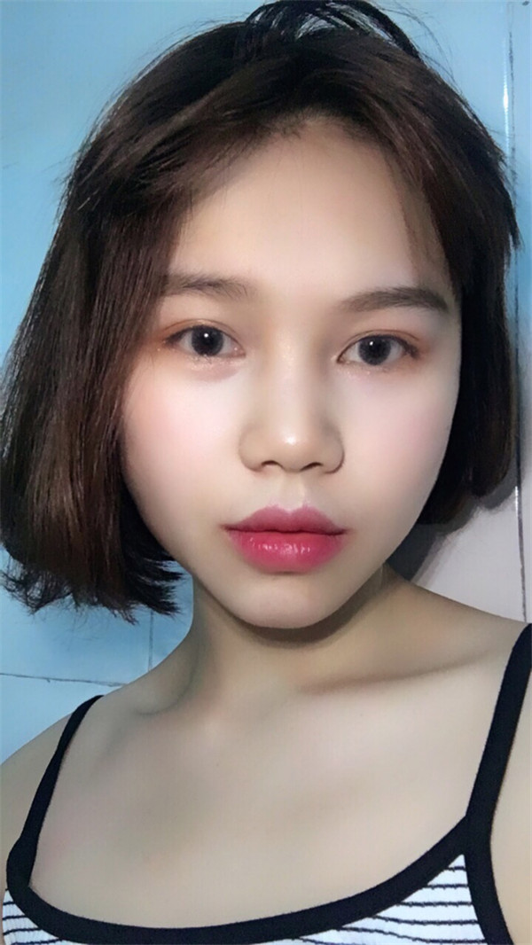 姐妹们,你们喜欢M唇吗?我做了M唇和自体脂肪填充额头,大家都来看看,觉得我做的怎么样呢?