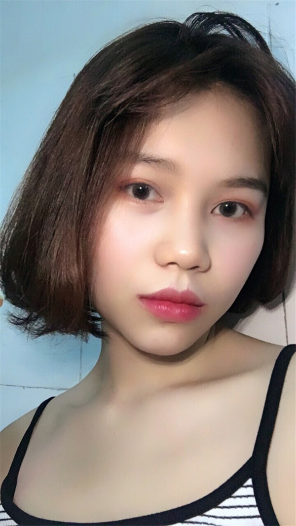 姐妹们,你们喜欢M唇吗?我做了M唇和自体脂肪填充额头,大家都来看看,觉得我做的怎么样呢?