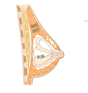 自体脂肪隆胸 VS 假体隆胸,你适合哪种?!
