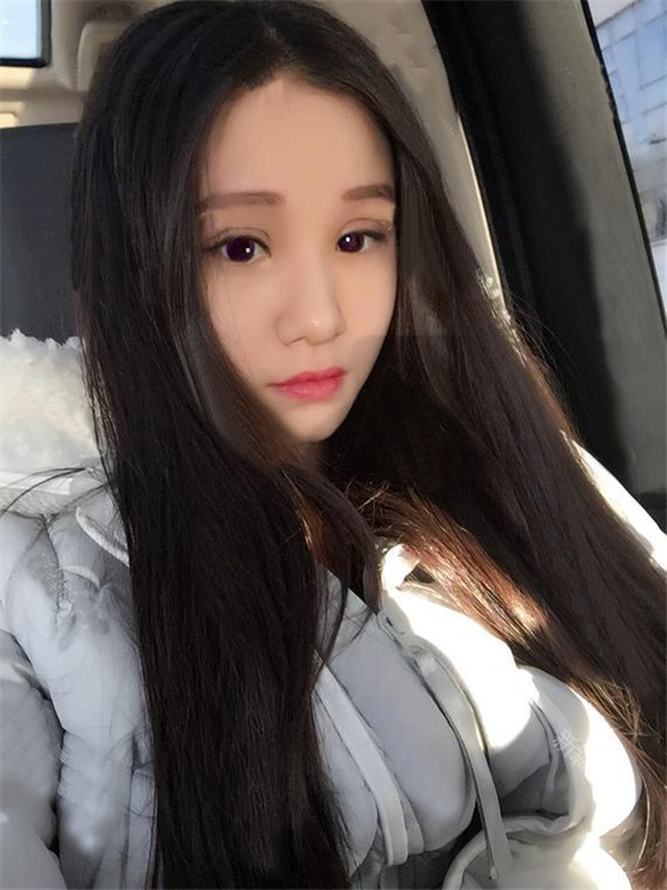 做过双眼皮的宝宝们进来看看我的双眼皮案例吧!看看我的双眼皮做的怎么样?我觉得做啦双眼皮之后眼睛都大了一倍~~~