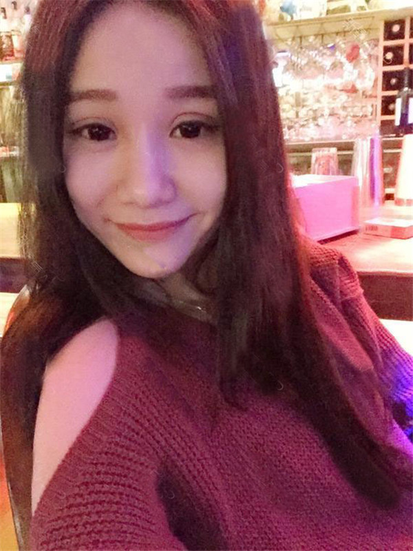 做过双眼皮的宝宝们进来看看我的双眼皮案例吧!看看我的双眼皮做的怎么样?我觉得做啦双眼皮之后眼睛都大了一倍~~~