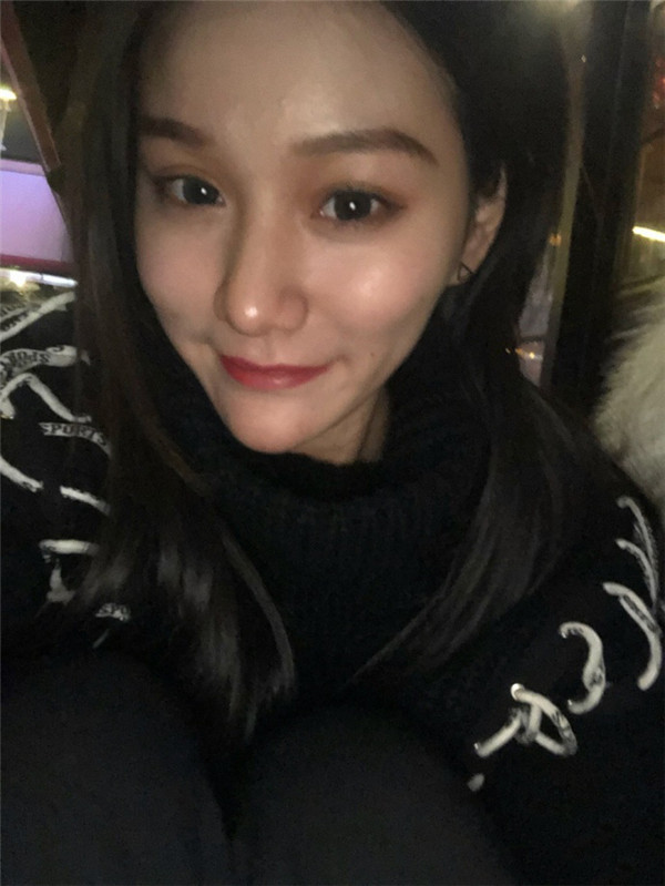 做过双眼皮的宝宝们进来看看我的双眼皮案例吧!看看我的双眼皮做的怎么样?我觉得做啦双眼皮之后眼睛都大了一倍~~~
