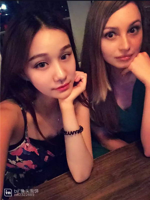 做过双眼皮的宝宝们进来看看我的双眼皮案例吧!看看我的双眼皮做的怎么样?我觉得做啦双眼皮之后眼睛都大了一倍~~~