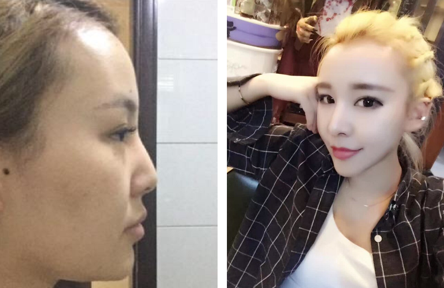 什么样的长相算是偏男相呢？主要看鼻子！