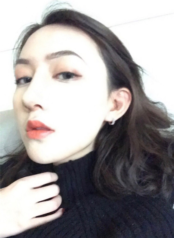 冬天好冷啊,美女们进来看看我的假体隆鼻案例吧!对了较近有个佛系游戏 养娃 大家有没有玩过阿