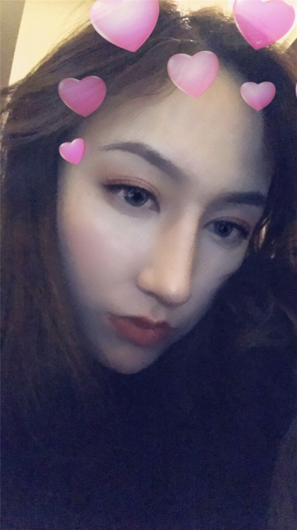 冬天好冷啊,美女们进来看看我的假体隆鼻案例吧!对了较近有个佛系游戏 养娃 大家有没有玩过阿