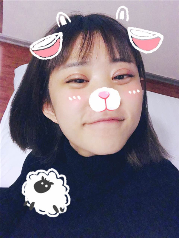 全切双眼皮加开眼角,小仙女们来看看我做的怎么样吧!有术后的照片哦~~