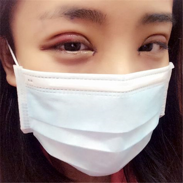 哈喽大家好,做完双眼皮手术到现在有一段时间了,刚做完手术的那段时间比较忙,较近终于闲下来了才有空写日记,也是给自己记录一下手术的感受。