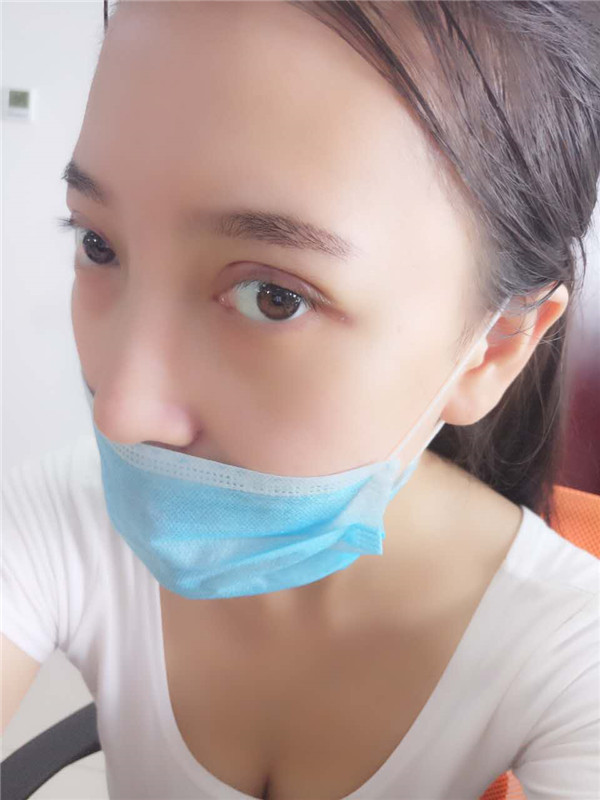 姐妹们,我去做了双眼皮手术!趁着过年好好恢复,宝宝们有没有和我一样做双眼皮的,快传授点有助恢复的方法给我吧~~~
