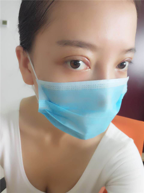 姐妹们,我去做了双眼皮手术!趁着过年好好恢复,宝宝们有没有和我一样做双眼皮的,快传授点有助恢复的方法给我吧~~~