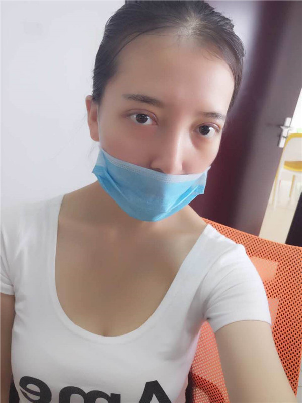 姐妹们,我去做了双眼皮手术!趁着过年好好恢复,宝宝们有没有和我一样做双眼皮的,快传授点有助恢复的方法给我吧~~~