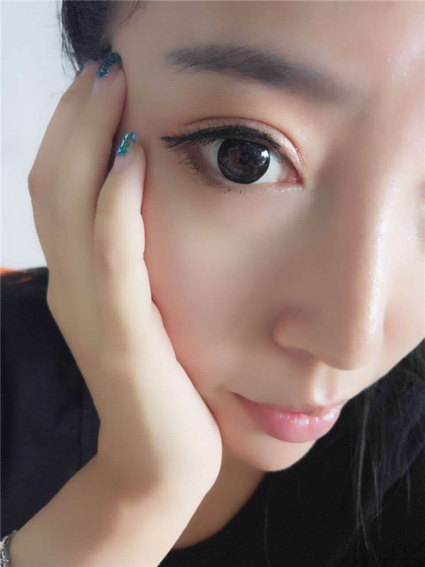 姐妹们,我去做了双眼皮手术!趁着过年好好恢复,宝宝们有没有和我一样做双眼皮的,快传授点有助恢复的方法给我吧~~~