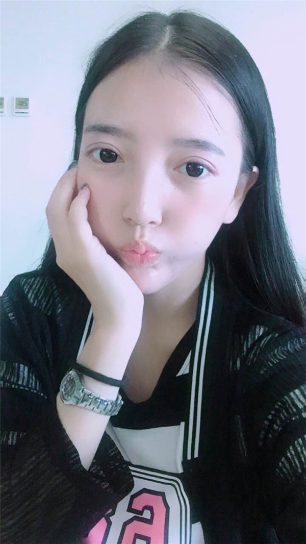 姐妹们,我去做了双眼皮手术!趁着过年好好恢复,宝宝们有没有和我一样做双眼皮的,快传授点有助恢复的方法给我吧~~~