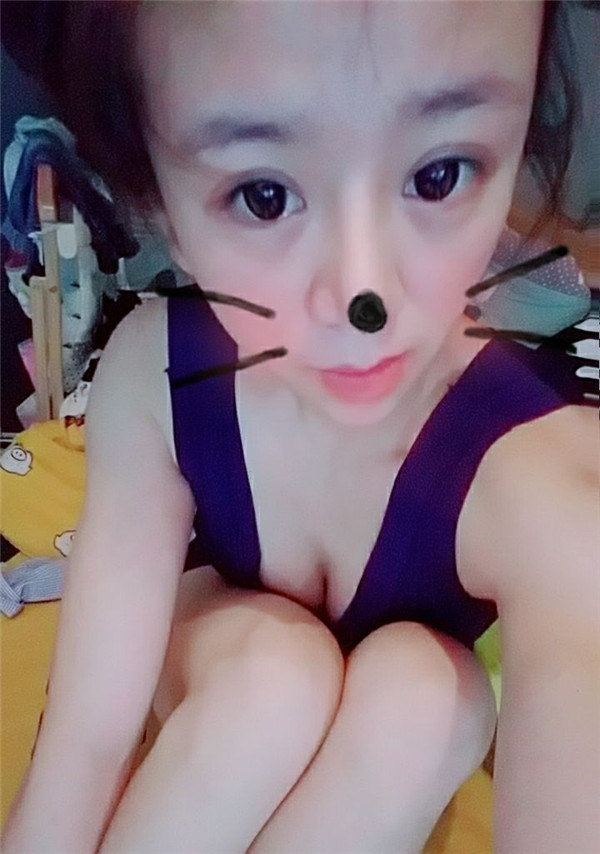 给姐妹们看看我的鼻部手术案例啦,我的鼻子恢复的很好,大家可不要羡慕我哦,哈哈哈哈,下面给大家看看我的隆鼻经历!哇咔咔,嘿嘿~~~~