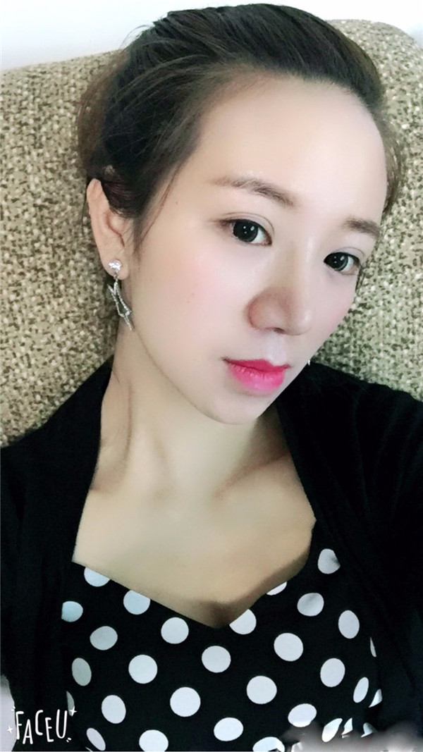 给姐妹们看看我的鼻部手术案例啦,我的鼻子恢复的很好,大家可不要羡慕我哦,哈哈哈哈,下面给大家看看我的隆鼻经历!哇咔咔,嘿嘿~~~~