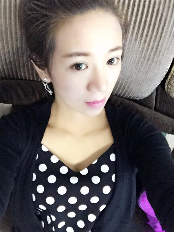 给姐妹们看看我的鼻部手术案例啦,我的鼻子恢复的很好,大家可不要羡慕我哦,哈哈哈哈,下面给大家看看我的隆鼻经历!哇咔咔,嘿嘿~~~~