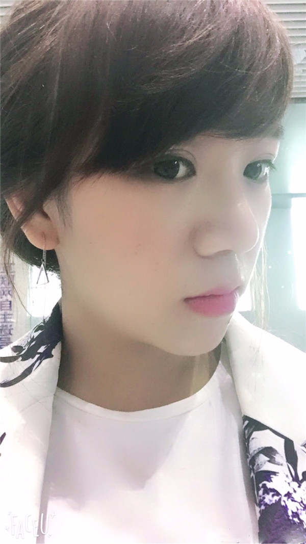 给姐妹们看看我的鼻部手术案例啦,我的鼻子恢复的很好,大家可不要羡慕我哦,哈哈哈哈,下面给大家看看我的隆鼻经历!哇咔咔,嘿嘿~~~~