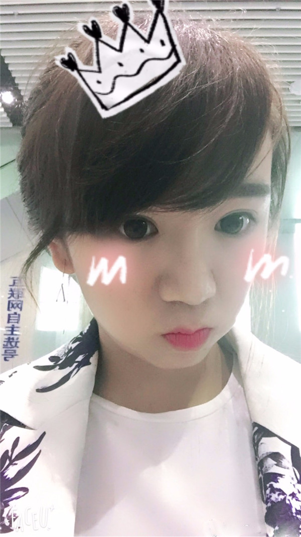 给姐妹们看看我的鼻部手术案例啦,我的鼻子恢复的很好,大家可不要羡慕我哦,哈哈哈哈,下面给大家看看我的隆鼻经历!哇咔咔,嘿嘿~~~~