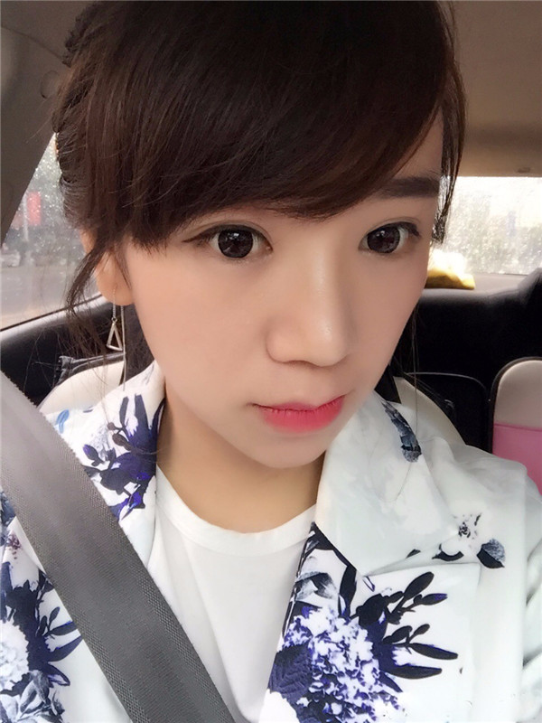给姐妹们看看我的鼻部手术案例啦,我的鼻子恢复的很好,大家可不要羡慕我哦,哈哈哈哈,下面给大家看看我的隆鼻经历!哇咔咔,嘿嘿~~~~