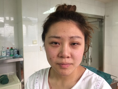 漂亮鼻子，侧颜杀