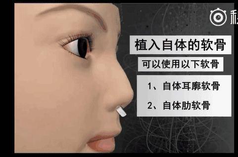 漂亮鼻子，侧颜杀