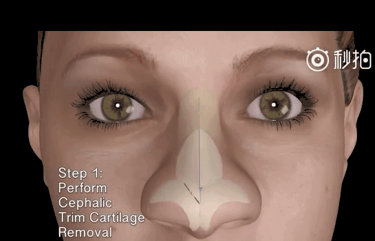 漂亮鼻子，侧颜杀