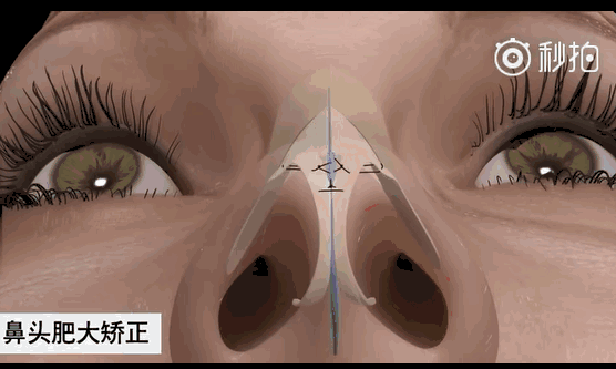 漂亮鼻子，侧颜杀