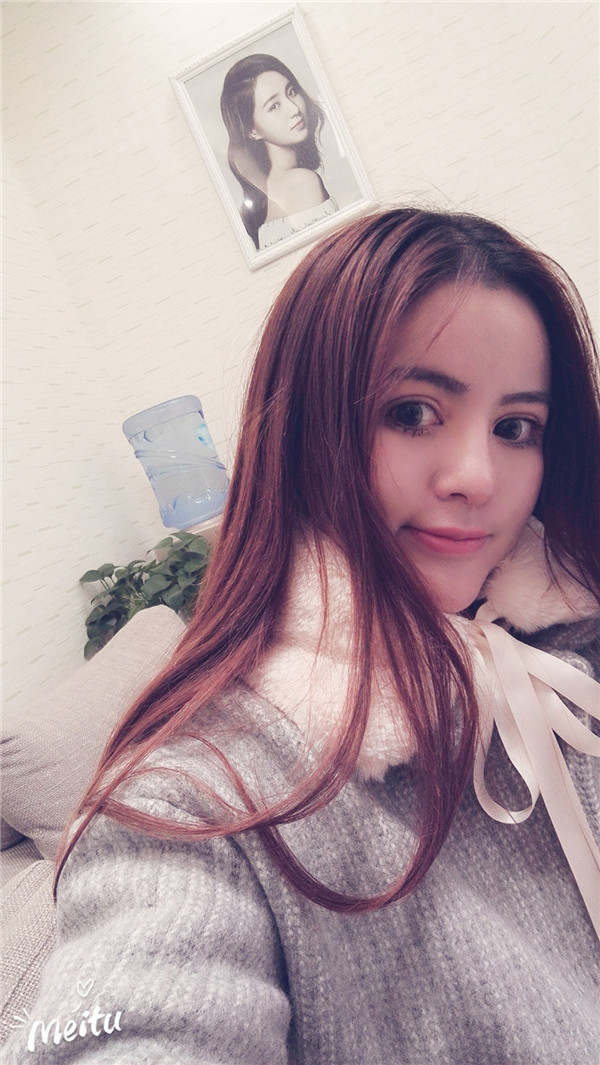 鼻修复】我的鼻子修复已经三个多月咯,有没有觉得现在的鼻子和我一脸配,有弧度、更自然的感觉,嘿嘿,所以爱美要趁早哦,2018必须美起来!!!