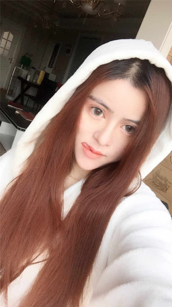 鼻修复】我的鼻子修复已经三个多月咯,有没有觉得现在的鼻子和我一脸配,有弧度、更自然的感觉,嘿嘿,所以爱美要趁早哦,2018必须美起来!!!
