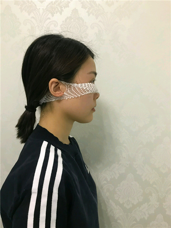 杭州艺星雷中元内切去眼袋