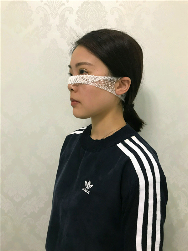 杭州艺星雷中元内切去眼袋