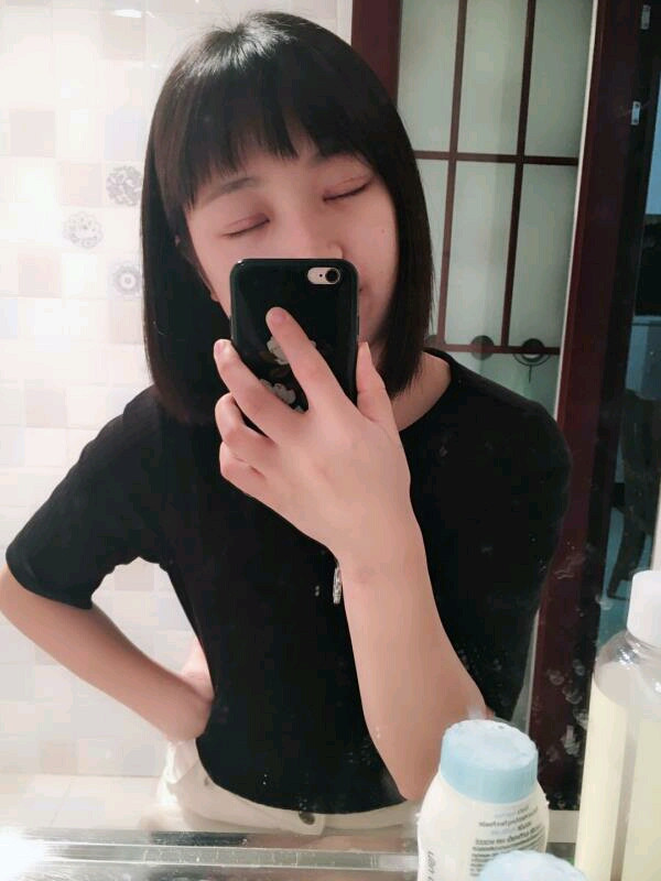 重庆军科陈宇割双眼皮