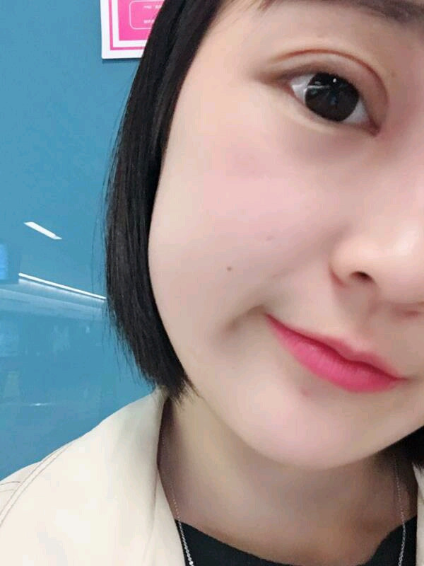 重庆军科陈宇割双眼皮