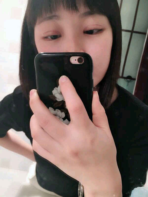 重庆军科陈宇割双眼皮