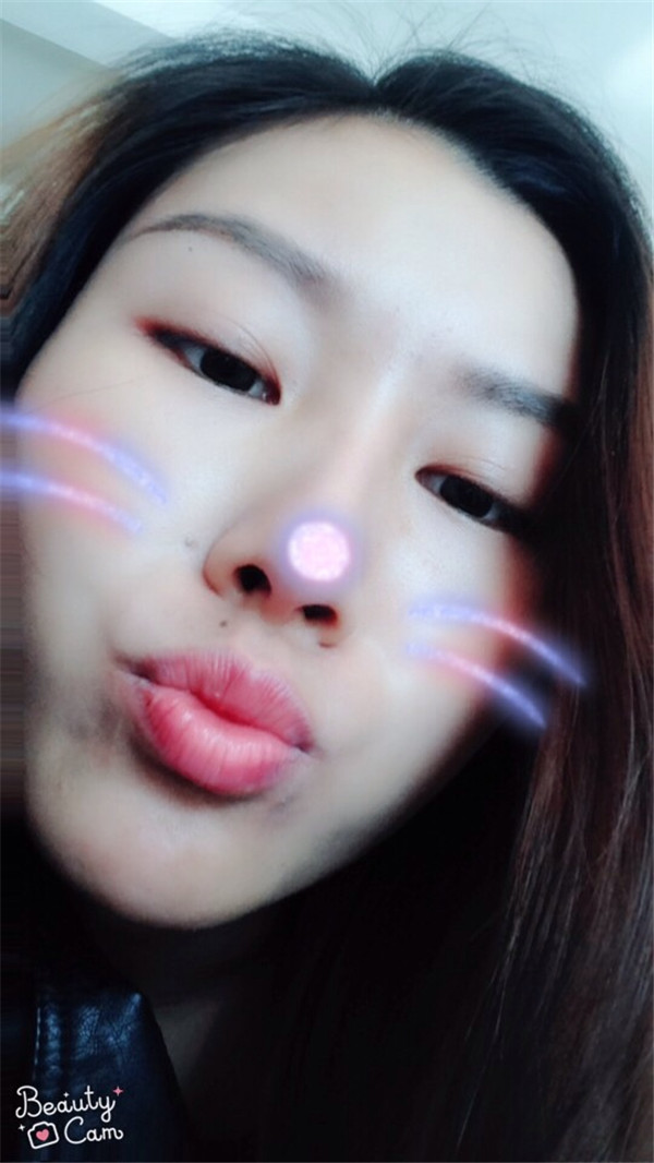 成都驻颜宋莉萍自体脂肪填充