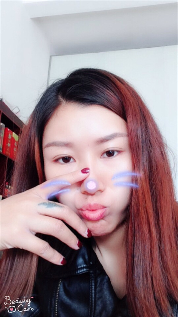 成都驻颜宋莉萍自体脂肪填充