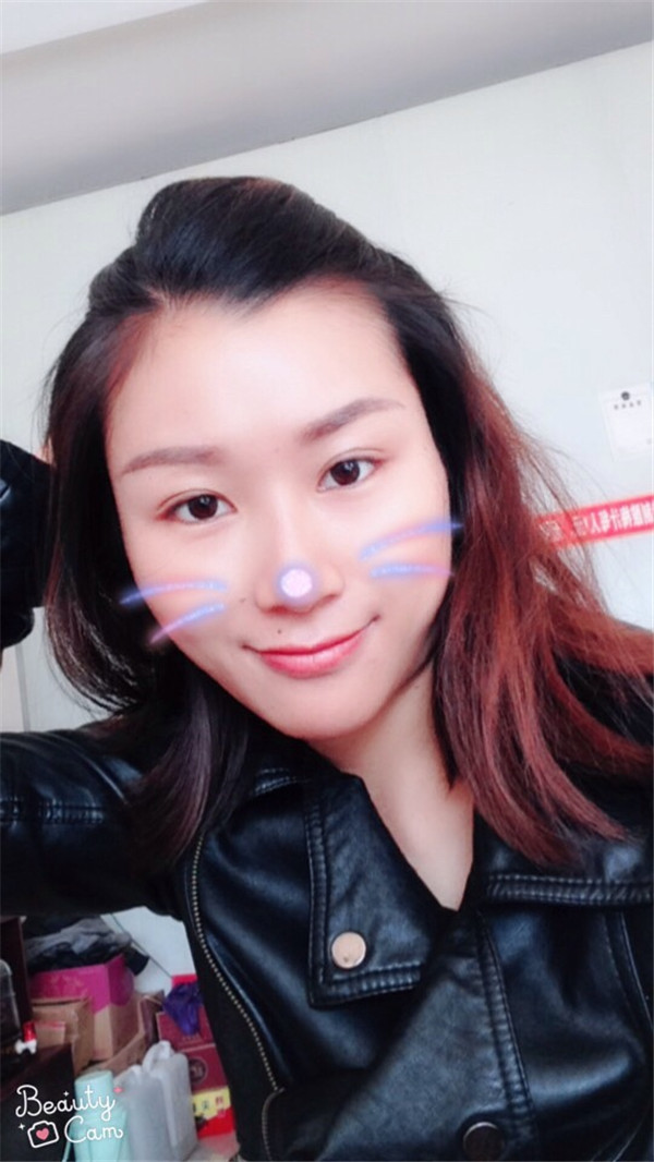 成都驻颜宋莉萍自体脂肪填充