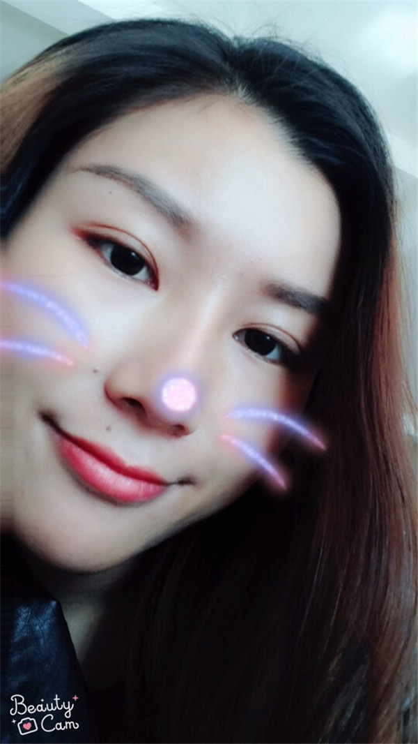 成都驻颜宋莉萍自体脂肪填充