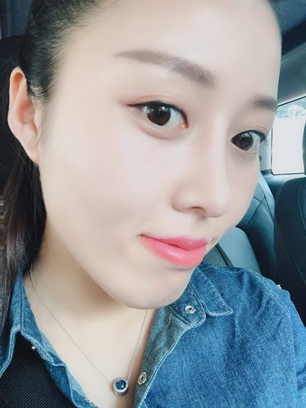 潍坊华美任传琦肋软骨隆鼻